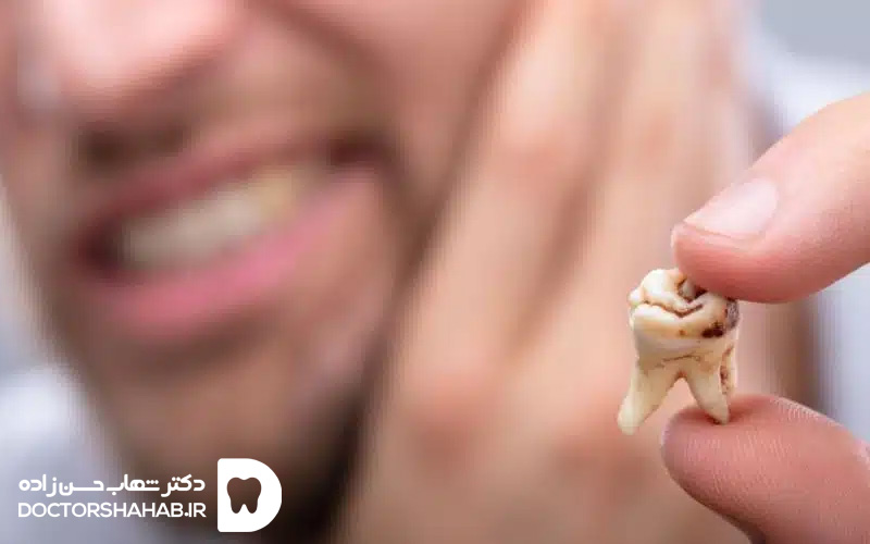 The cause of tooth decay