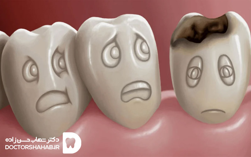 Damaged tooth repair methods