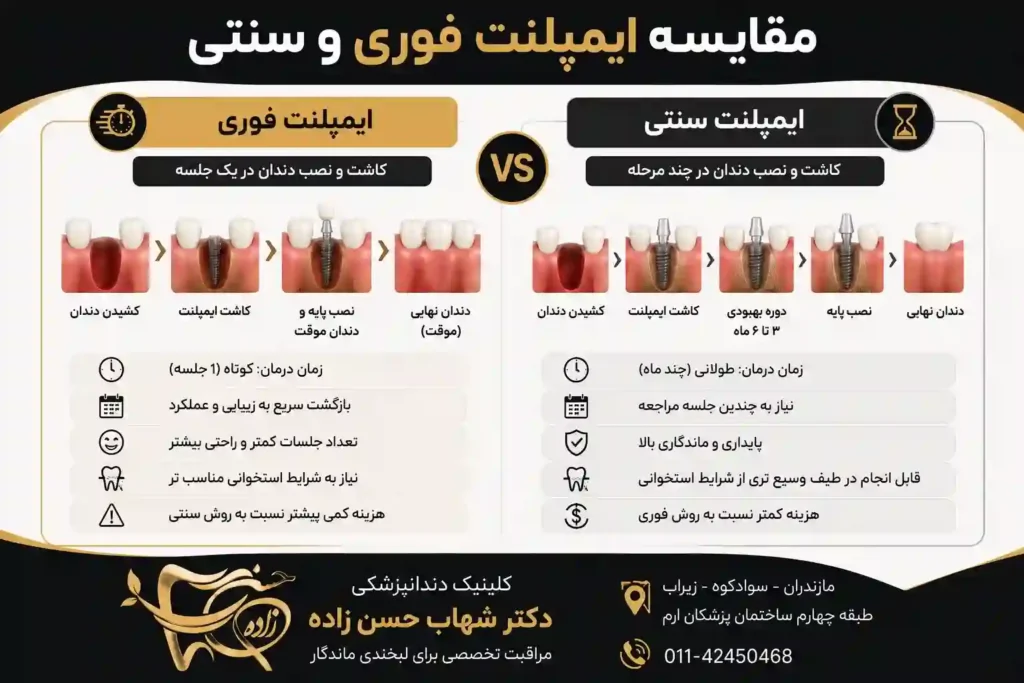 مقایسه ایمپلنت فوری و سنتی