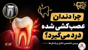 علت درد دندان عصب کشی شده